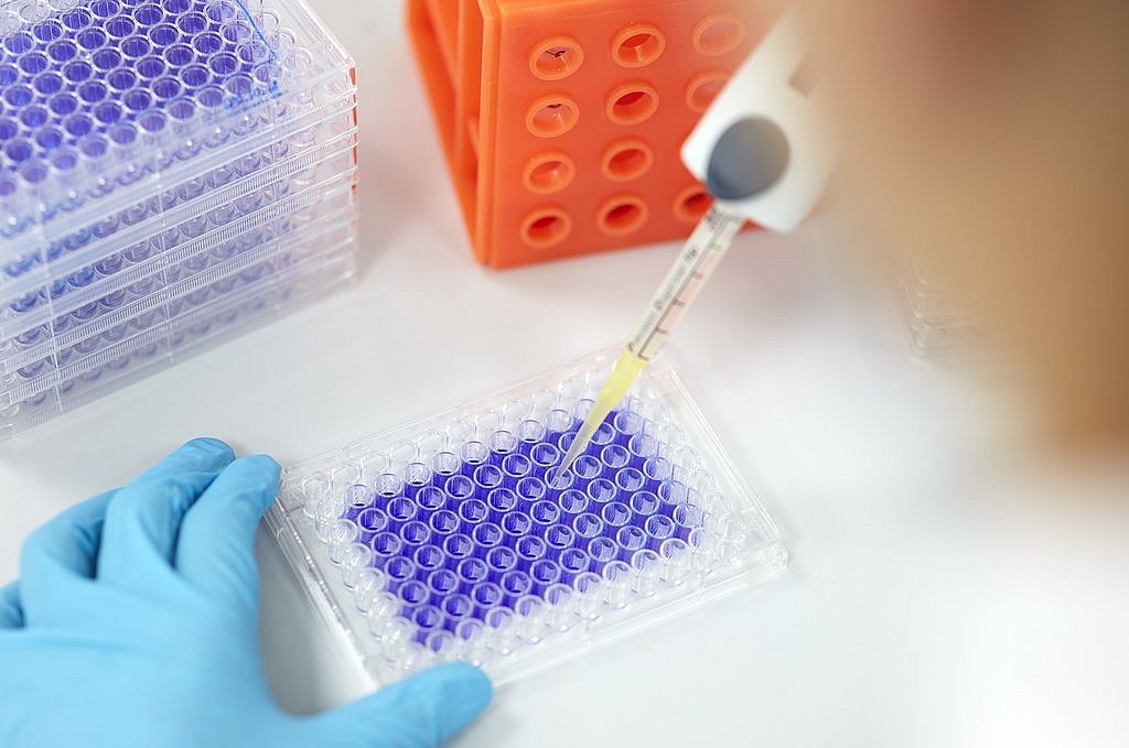 Application of the sample extract on nutrient solution with fibroblasts (connective tissue cells)