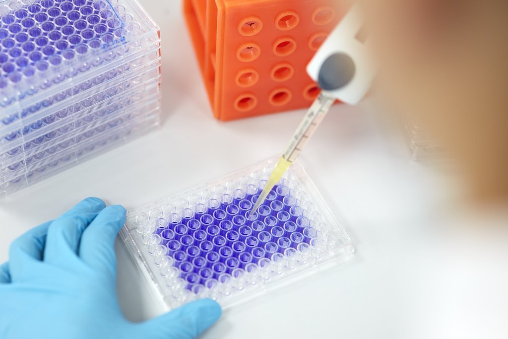 Application of the sample extract on nutrient solution with fibroblasts (connective tissue cells)